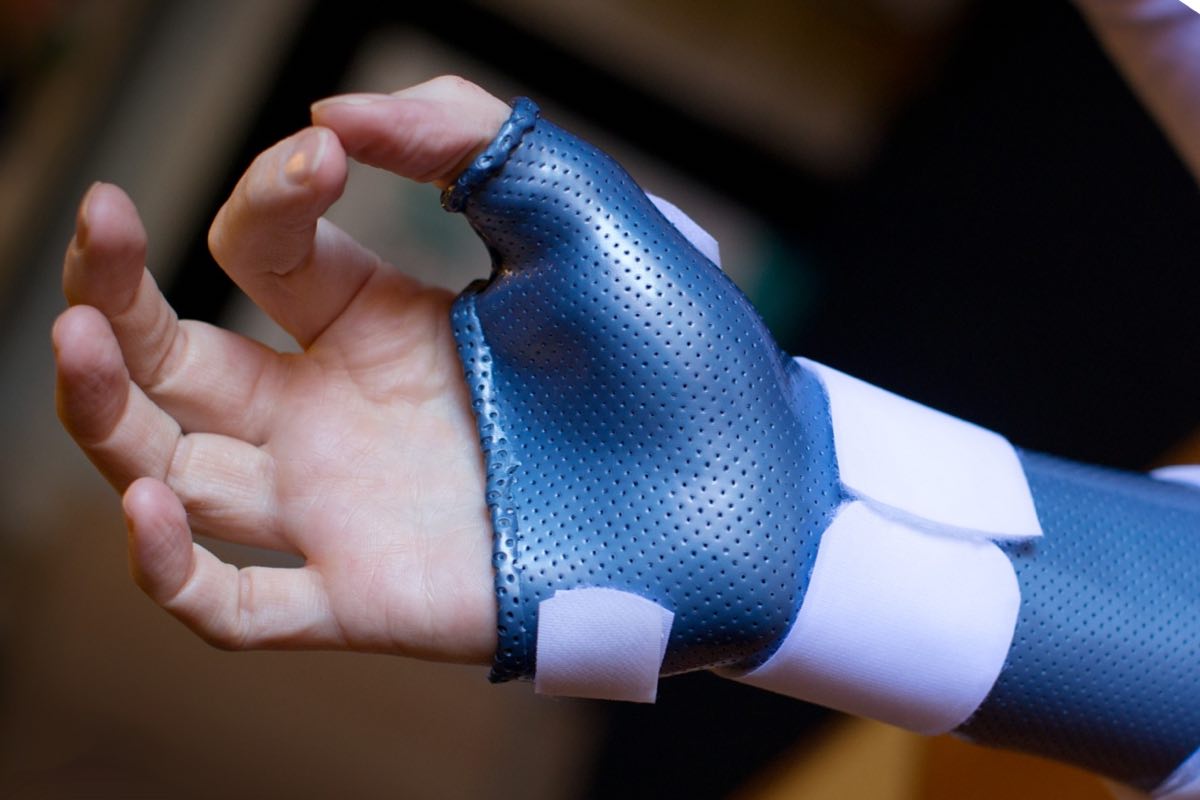 Custom Orthoses, Splints, Sports Braces, Guards & Waterproof Casts » Central Victorian Hand Therapy Bendigo